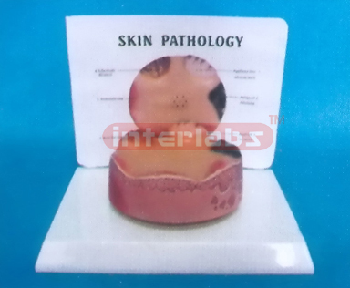 DESK-TYPE COMMON PATHOLOGIES MODEL OF SKIN CARC-INOMASERIES WITH DESCRIPTION PLATE